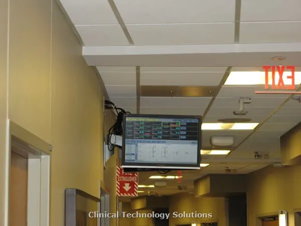 Hallway ECG monitor installation